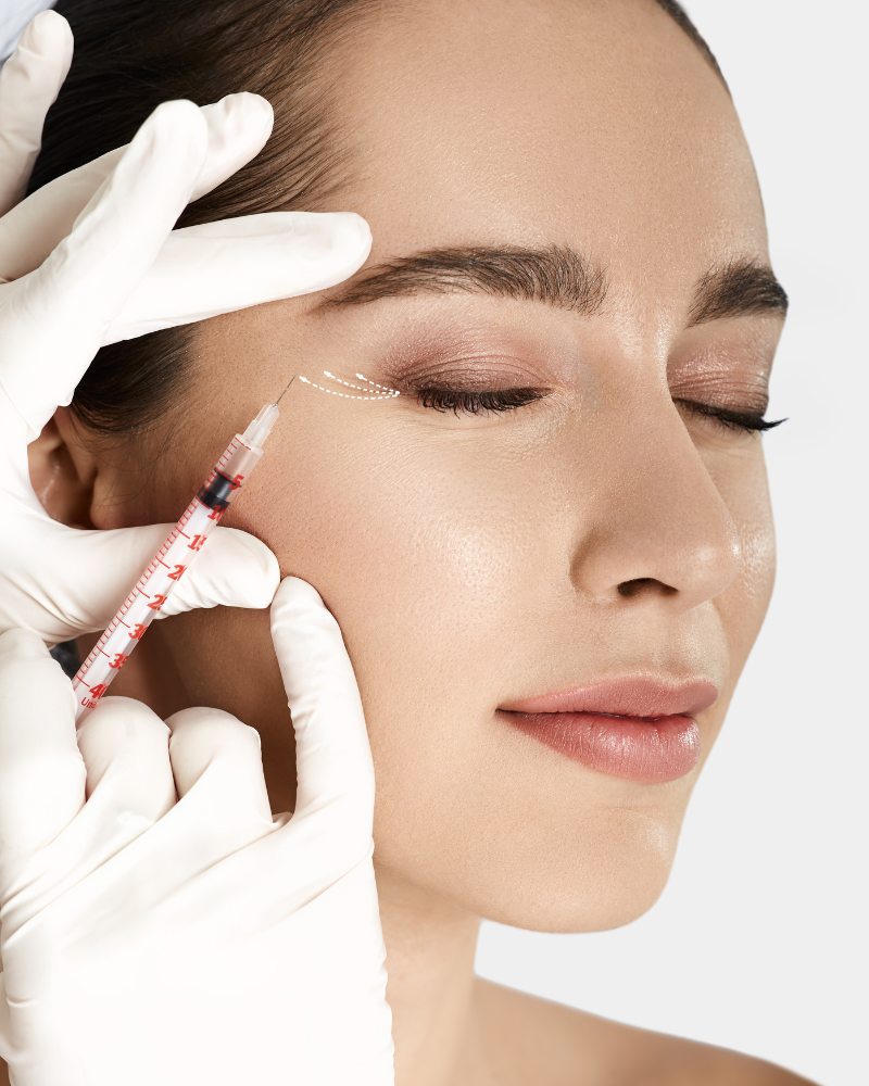 Anti Wrinkle Treatments Nottingham